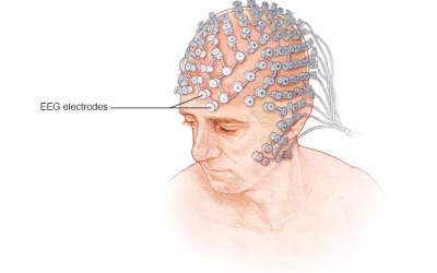 my00296_im03979_bn7_eegthu_jpg